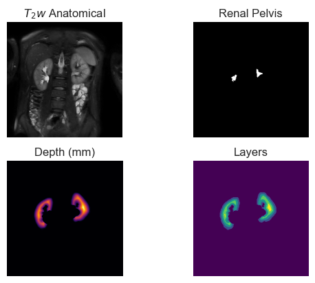 ../_images/examples_generating_layers_5_1.png